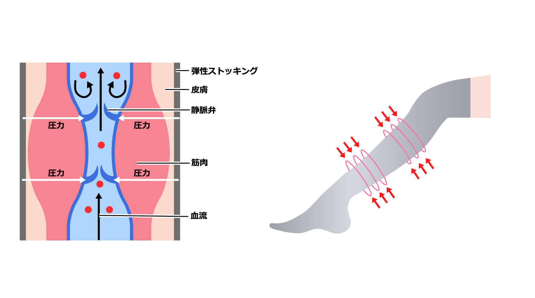 弾性ストッキング圧迫療法 - 医療法人清和会秋田 形成外科